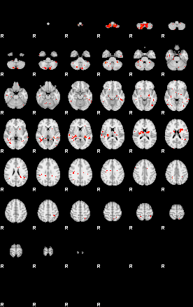 Patients 29575 102