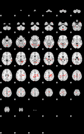 Patients 29591 90