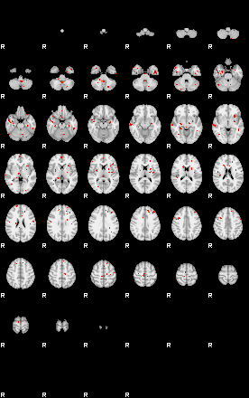 Patients 29595 3