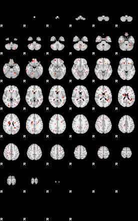 Patients 29595 32