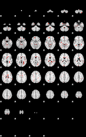 Patients 29606 174