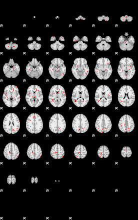 Patients 29612 18