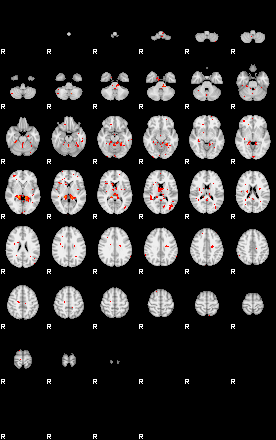 Patients 29613 185