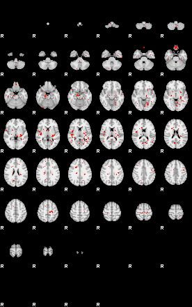 Patients 29613 34