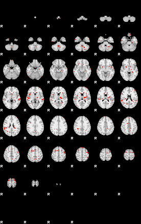 Patients 29613 98