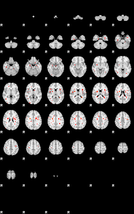 Patients 29615 102