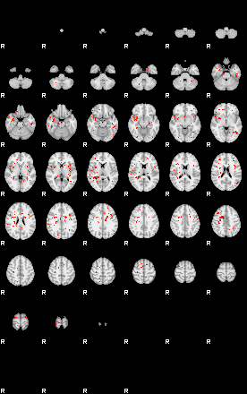 Patients 29615 19