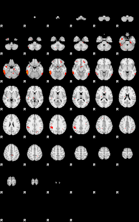 Patients 29670 180