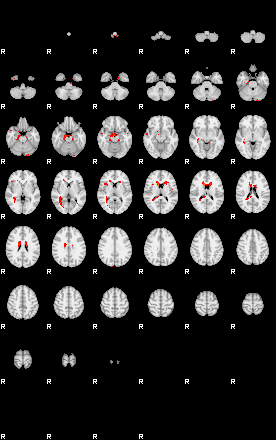 Patients 29671 70