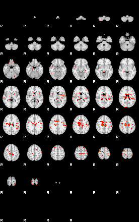 Patients 29732 4