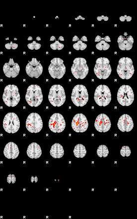 Patients 30000 181