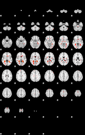 Patients 30001 95