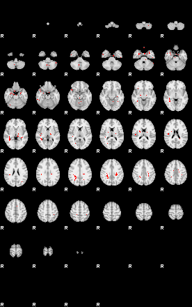 Patients 30017 79