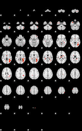 Patients 30017 85