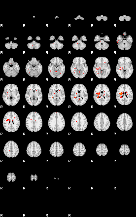 Patients 30018 92