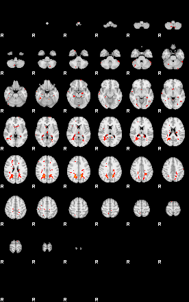 Patients 30019 162