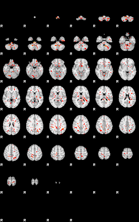 Patients 30187 32