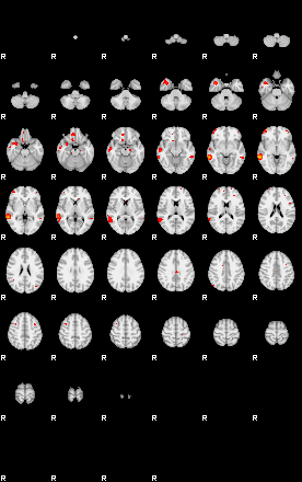 Patients 29174 97