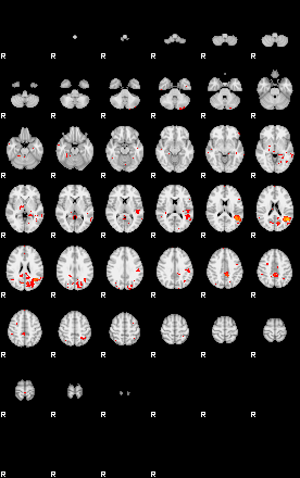 Patients 29007 187