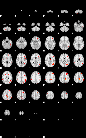 Patients 29188 191