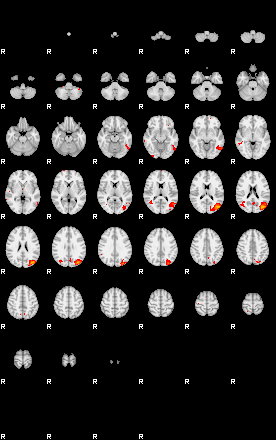 Patients 29741 8