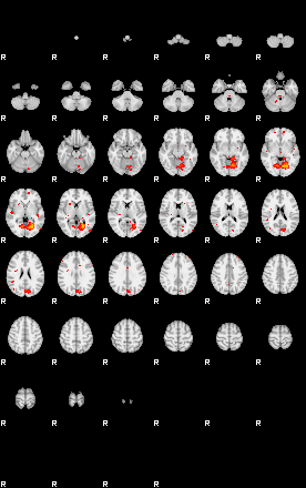 Patients 29172 191