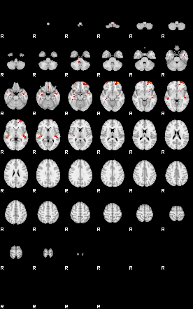 Patients 28679 193