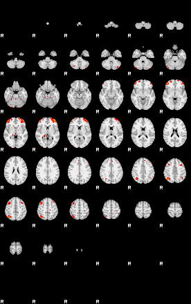 Patients 29096 125