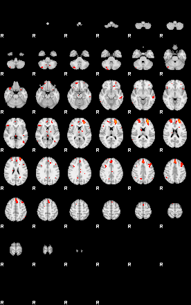 Patients 29187 166