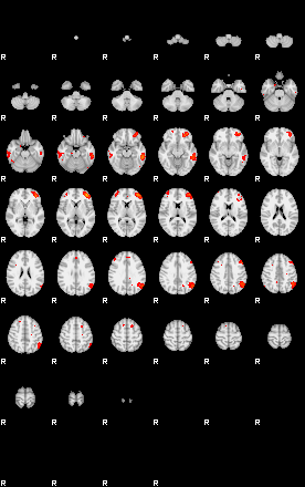 Patients 29161 34