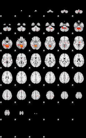 Patients 29097 29