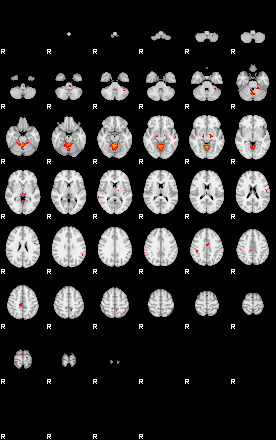 Patients 29108 30