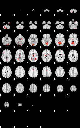 Patients 29116 100