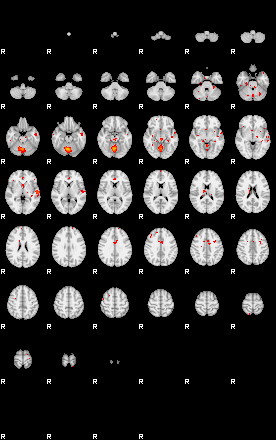 Patients 29163 192