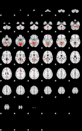 Patients 29178 89