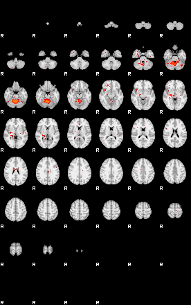 Patients 29507 29