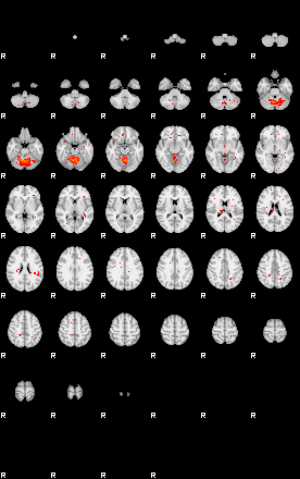 Patients 30010 60