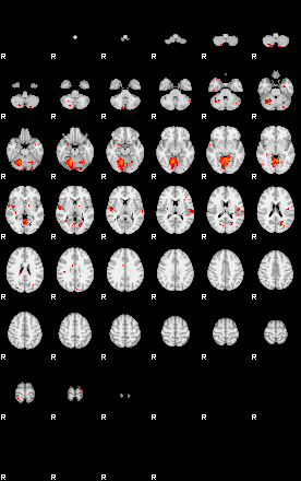 Patients 29869 98