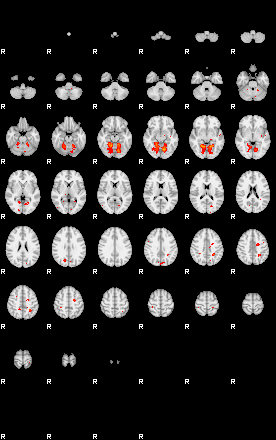 Patients 29200 109