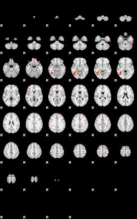 Patients 28903 139