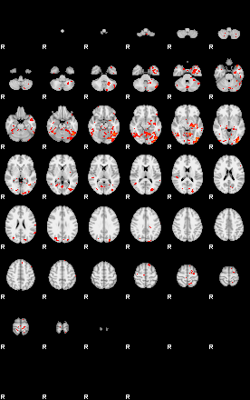 Patients 29007 90