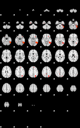 Patients 29159 140