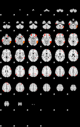 Patients 29170 153