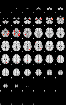 Patients 29185 106