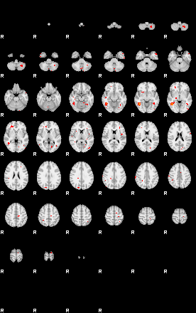 Patients 29203 151