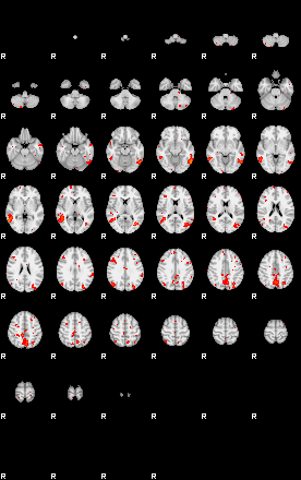 Patients 29204 180