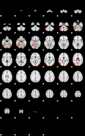 Patients 29213 180