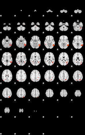 Patients 29290 126