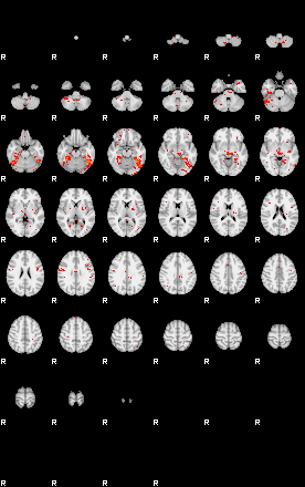 Patients 29562 120