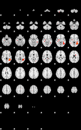 Patients 29678 194